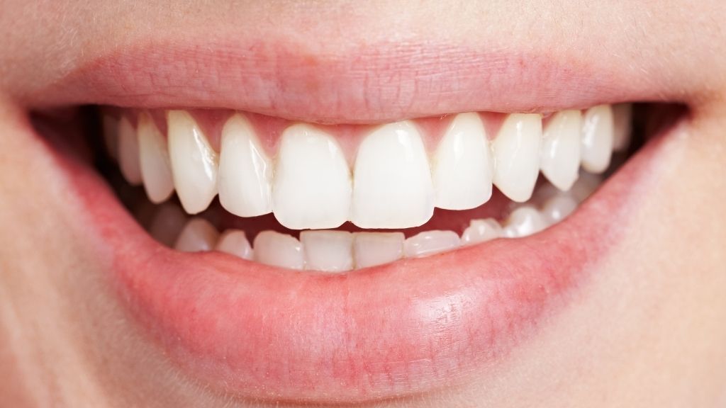 Gummy Smiles Treatment in Los Angeles