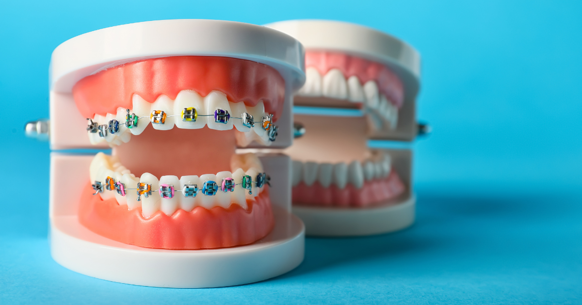 Schedule Orthodontic Care With PhD Dental Today image