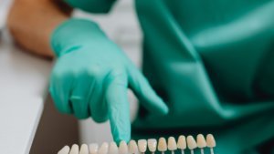 What the Veneers Placement Process Looks Like in Los Angeles