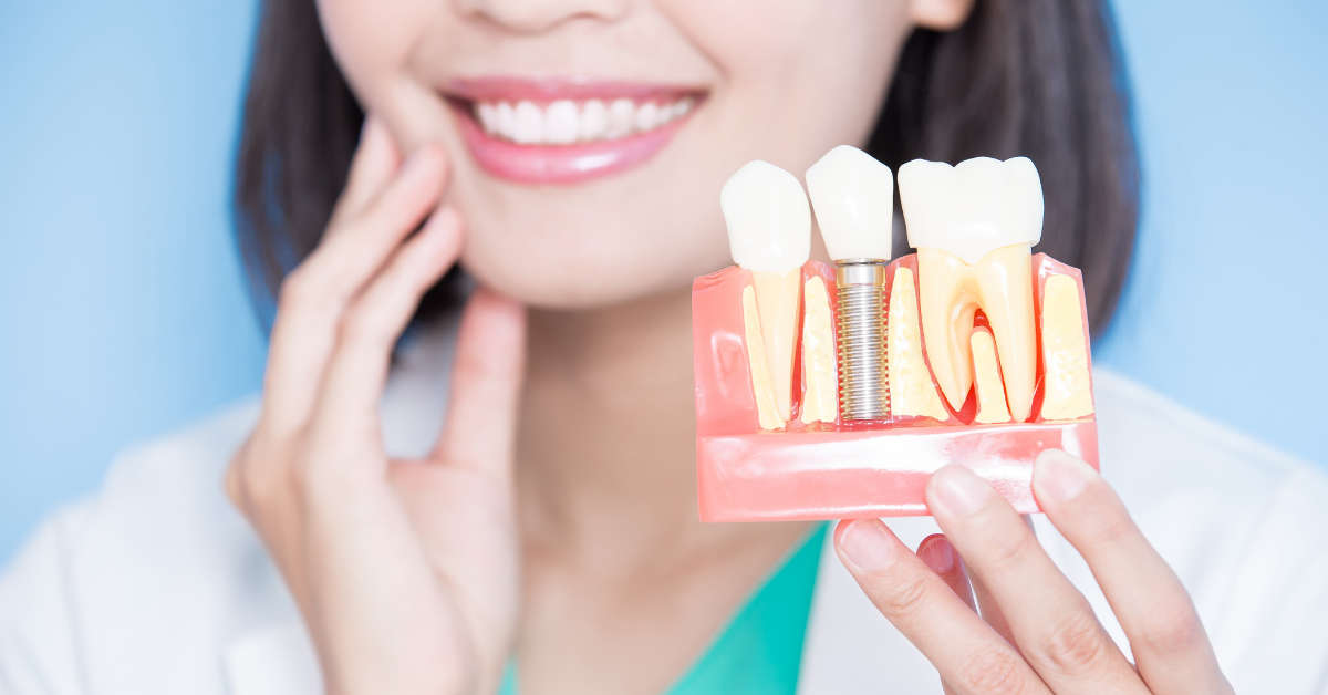 Why Endosteal Implants in Westchester Are the Gold Standard for Tooth Replacement img