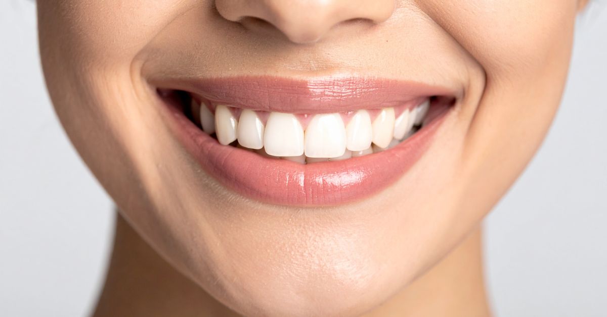 Teeth Whitening in Inglewood