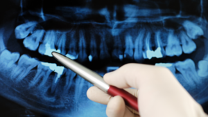 Technology Used in Full Mouth Reconstruction Procedures