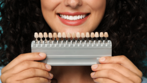 Finding the Right Los Angeles Cosmetic Dentist for Same-Day Veneers