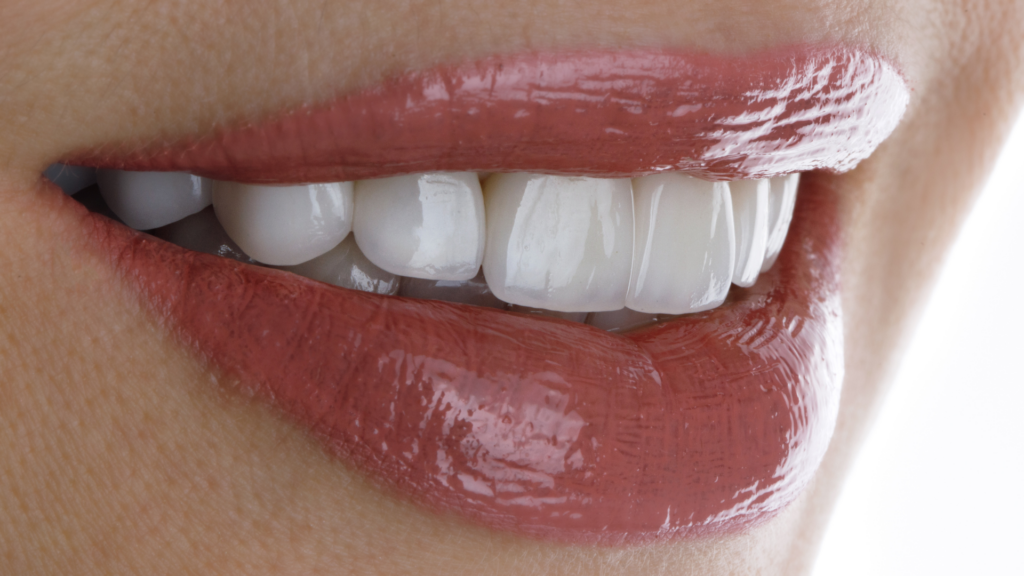 How Same-Day Veneers Help Save Time and Money in Los Angeles