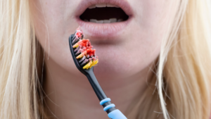 How a Periodontist in Los Angeles Can Treat Gingivitis Before It Becomes a Problem