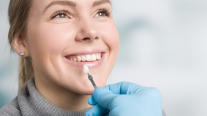 What Makes a Good Candidate for Same-Day Veneers