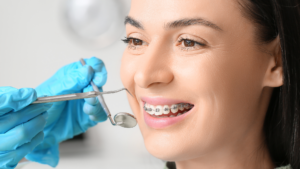When To Seek Accelerated Orthodontics in Los Angeles