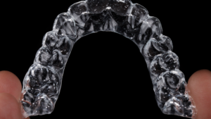 Why Orthodontic Consultations Are Important Before Choosing Invisalign