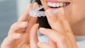 Why Teens in Los Angeles Often Prefer Invisalign Aligners