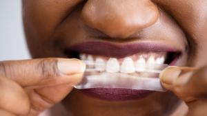 5 Safe Ways to Brighten Your Smile Without Damaging Enamel