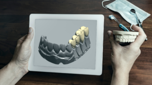 How Digital Technology Speeds Up Dental Crown Treatment