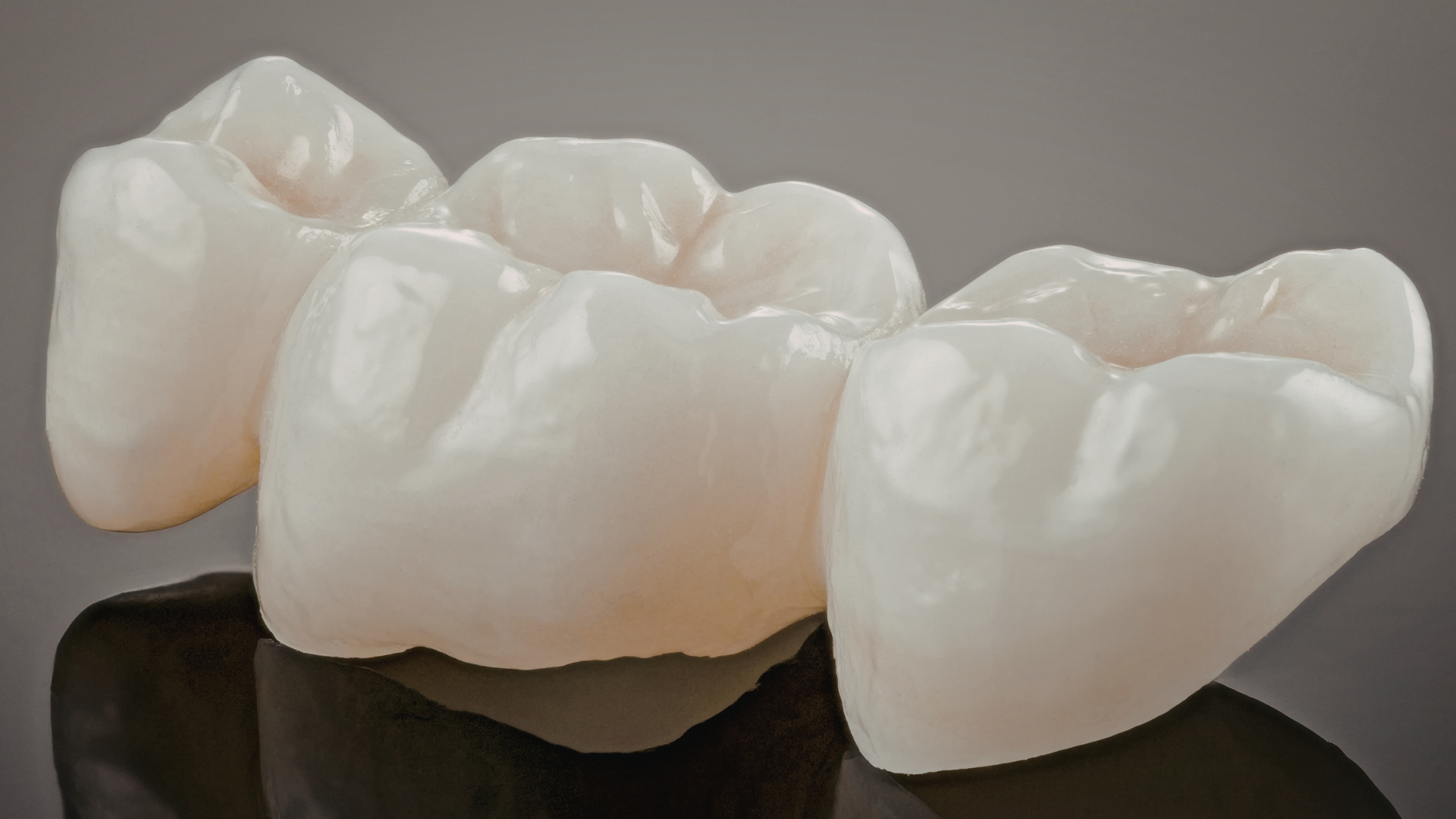 How Long Does a Dental Crowns Procedure in Los Angeles Take?