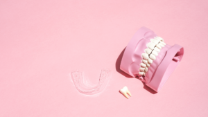 How Permanent Retainers Help Protect Orthodontic Results in Los Angeles