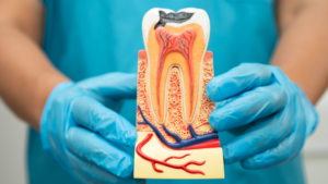 How Root Canal Therapy Protects Long-Term Oral Health