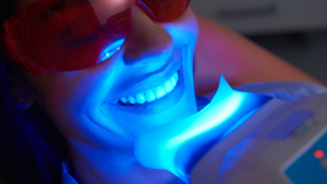 How Teeth Whitening Treatment in Los Angeles Can Help You Achieve a Brighter Smile