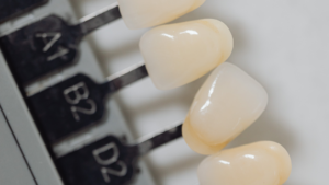 Schedule an Appointment to Get Your Teeth Whitened in Los Angeles Today