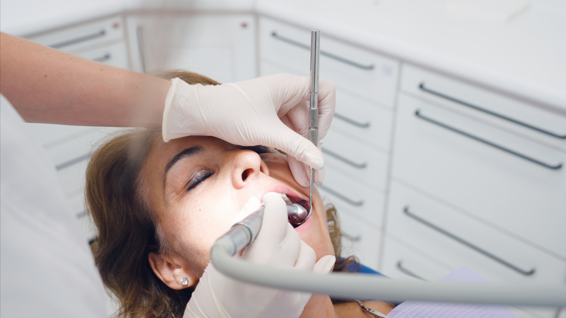 What Are My Options After a Traumatic Dental Injury in Los Angeles?