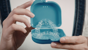 Why Get a Permanent Retainer Over a Plastic One in Los Angeles