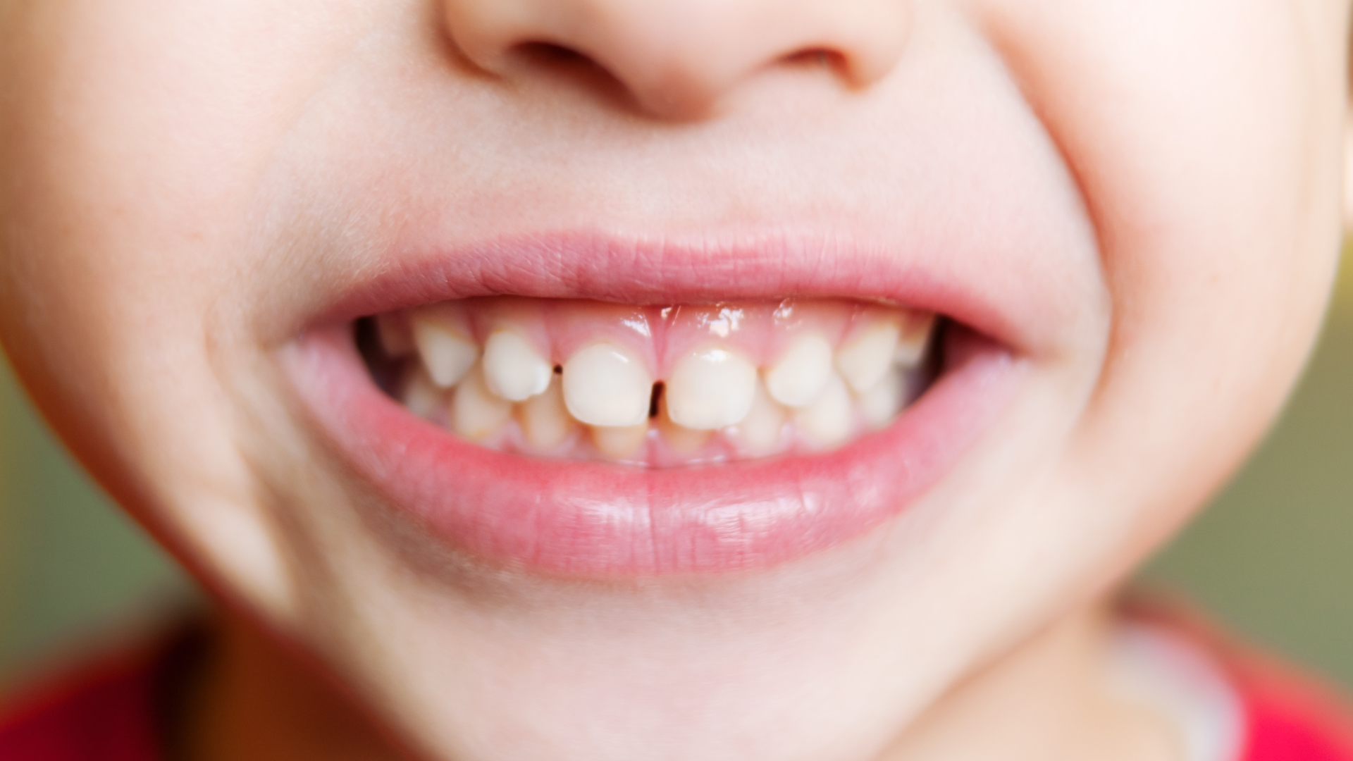 Schedule an Appointment for Your Child's First Pediatric Dentist Checkup in LA County Today