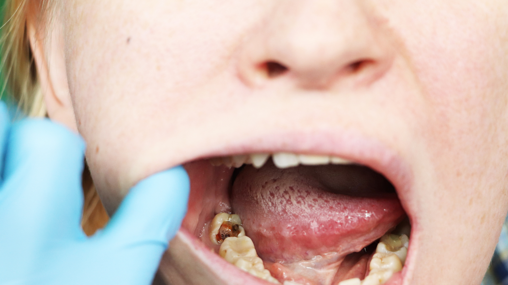 The Importance of Regular Dental Checkups Throughout Childhood in Los Angeles